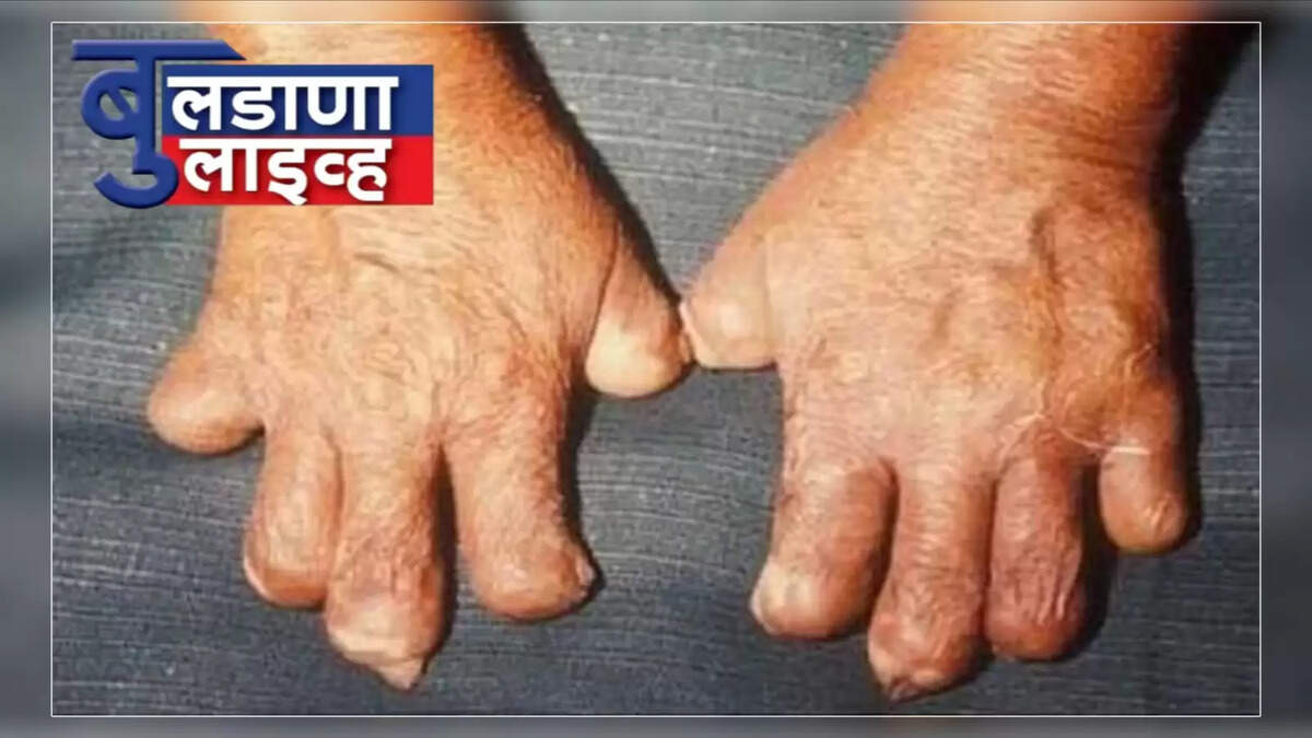 बुलडाणा